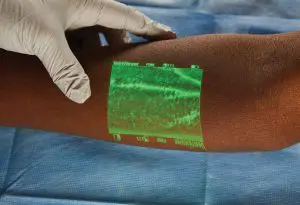 Vein viewer: captura de veias dos pacientes