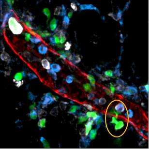 A imagem ilustra o escape das células dendríticas, em verde, para o tecido adiposo mesentérico pela parede do vaso linfático, em vermelho