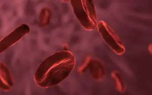 anemia sideroblástica