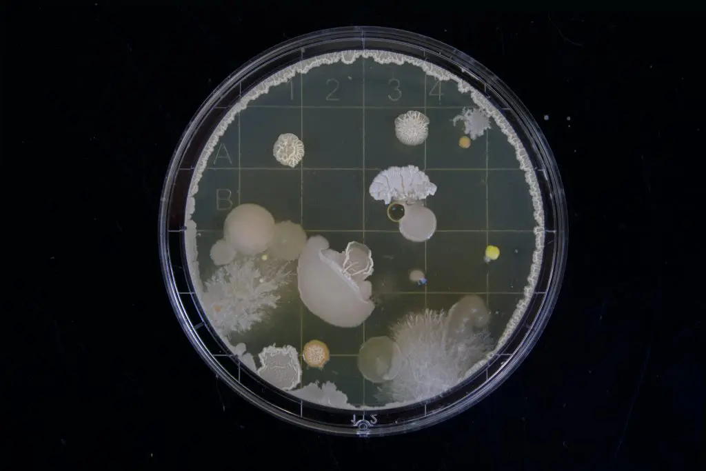 Bactérias: características, tipos, reprodução - Brasil Escola