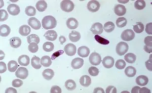 Protozoario-do-genero-Plasmodium-causador-da-malaria