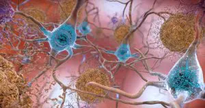20210621_neuronio_alzheimer