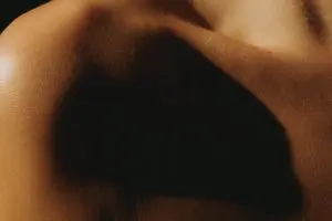 dermatite herpetiforme